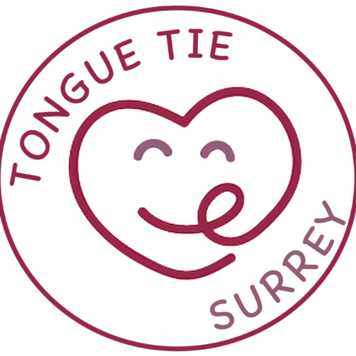 Tongue Tie Surrey