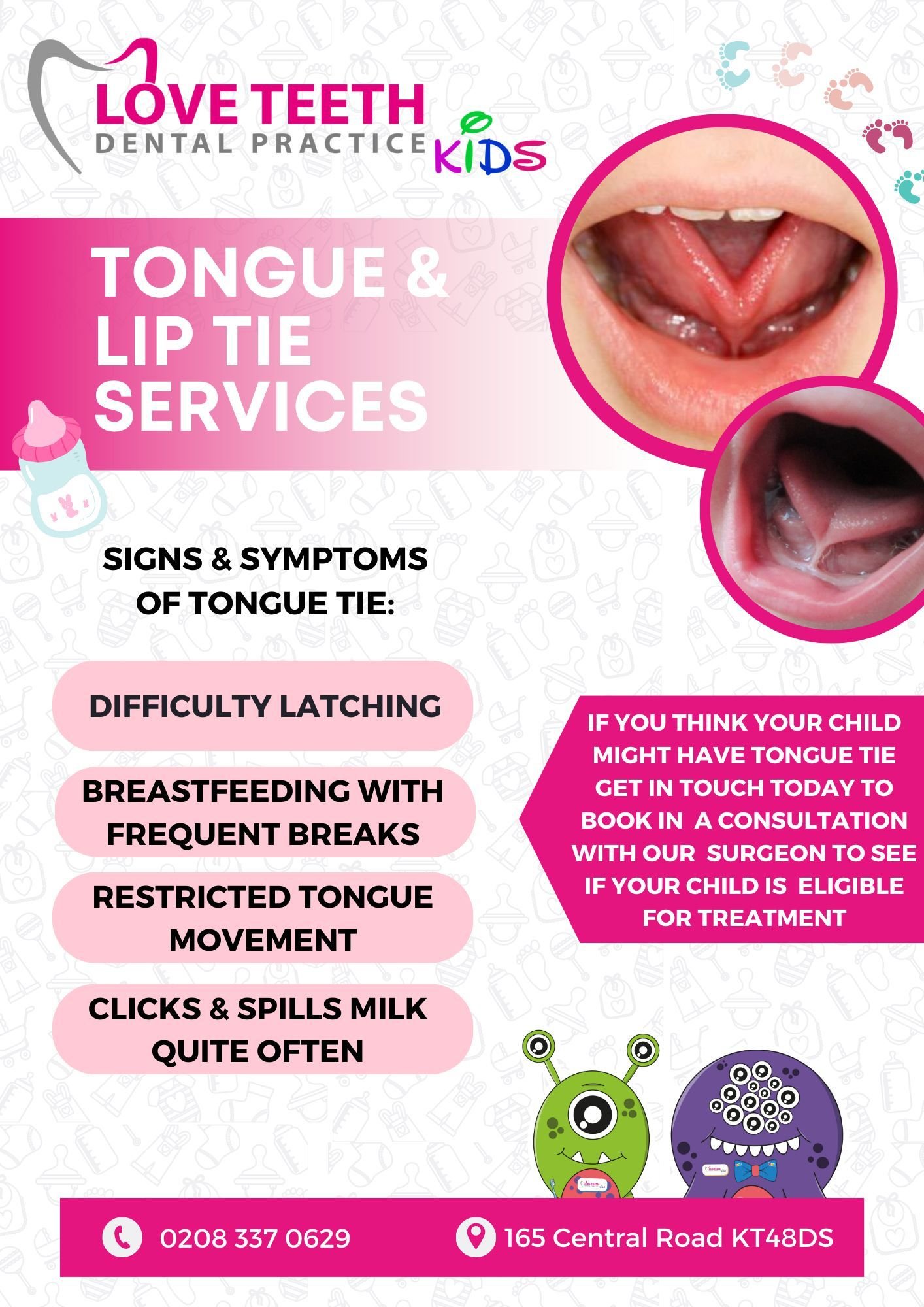 Tongue Tie Surrey offers